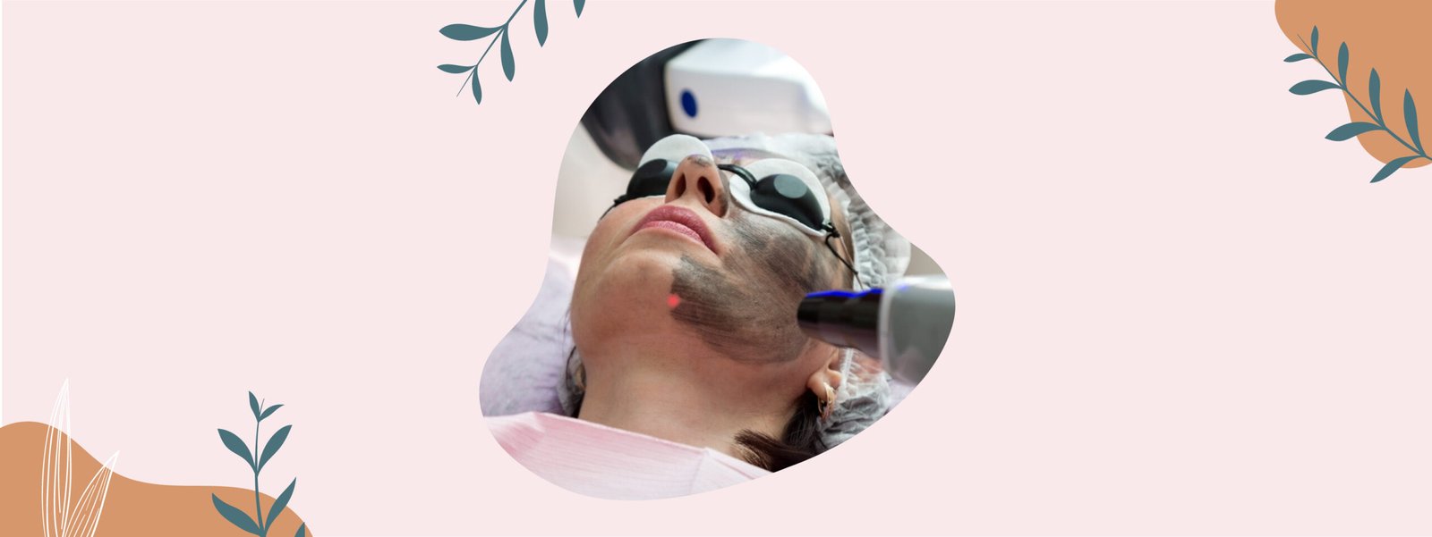Carbon Laser Peel: New Age Skin Treatment