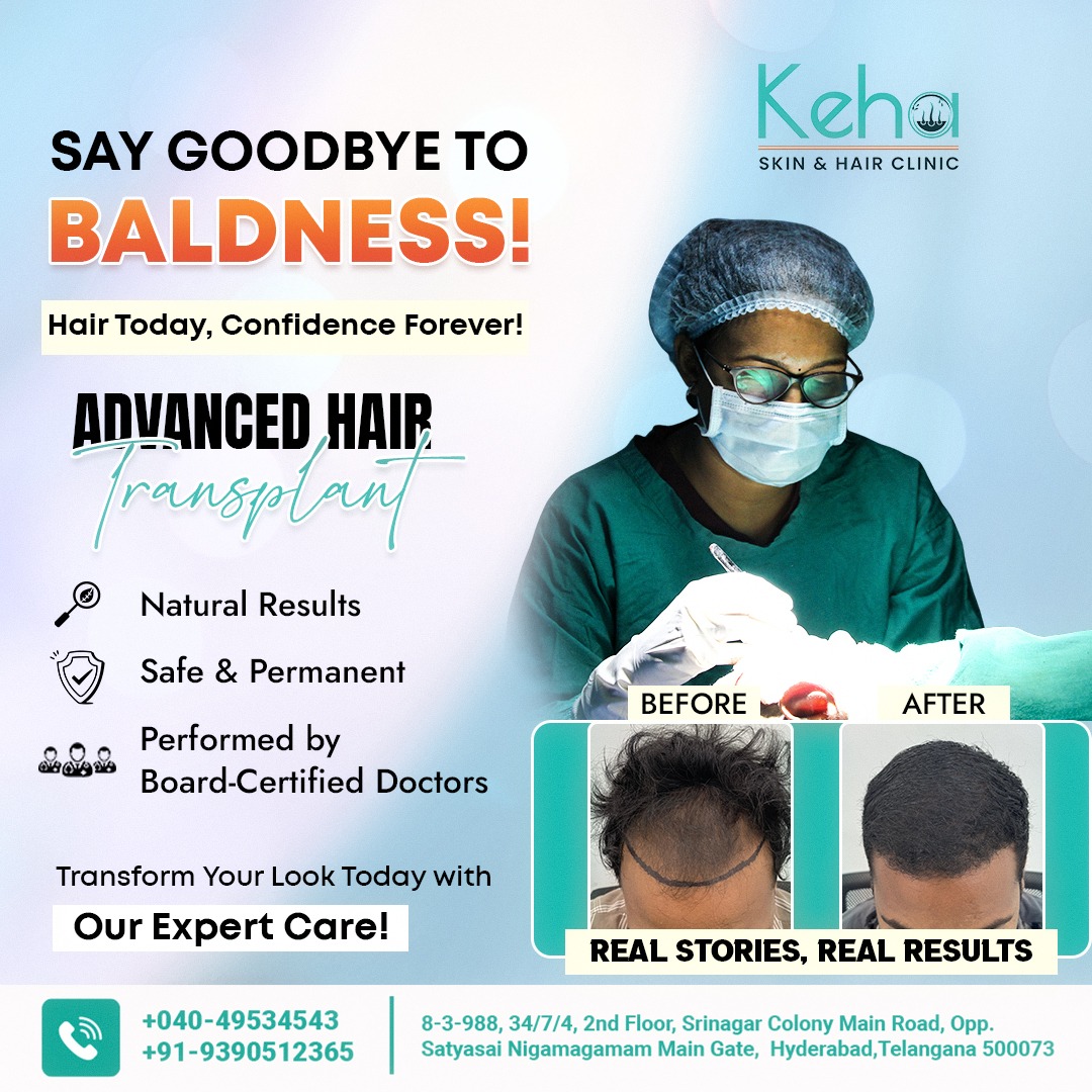 baldness-treatment-banner