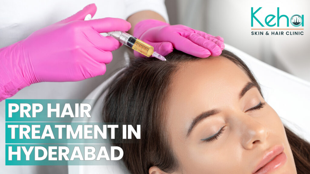 prp hair treatment in hyderabad