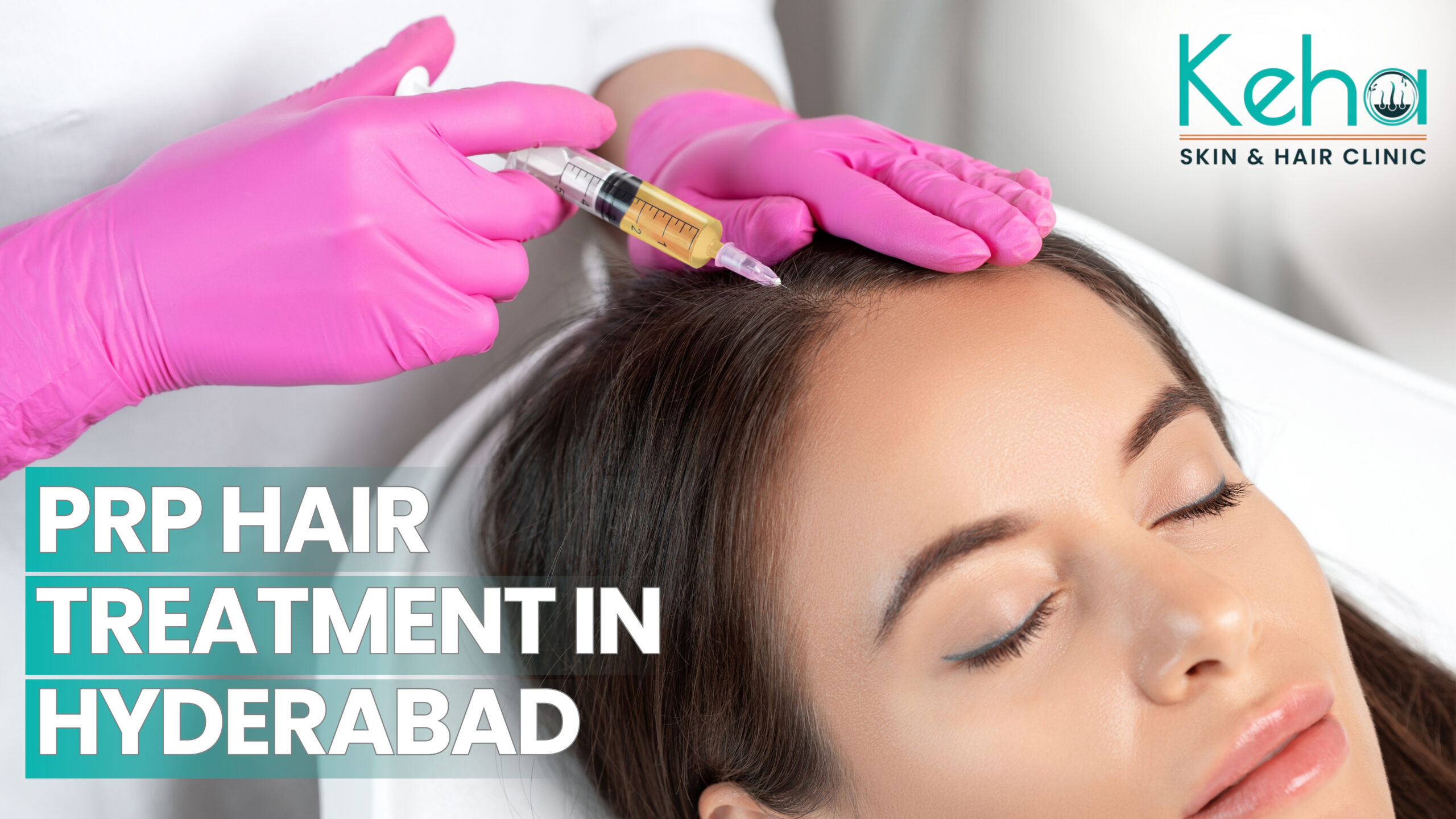 prp hair treatment in hyderabad