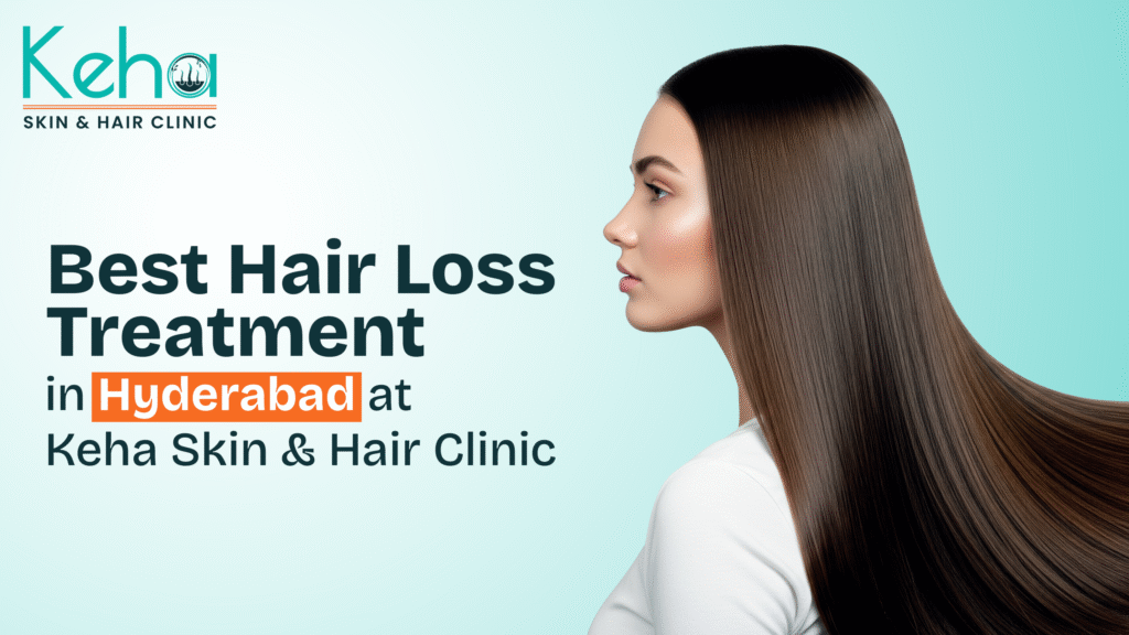 best hair loss treatment in hyderabad