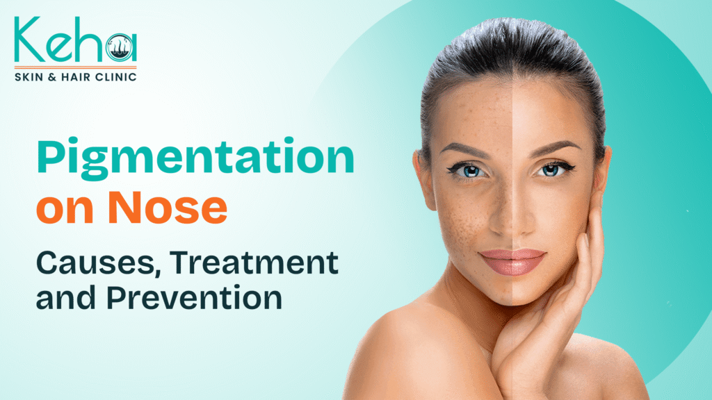 pigmentation on nose