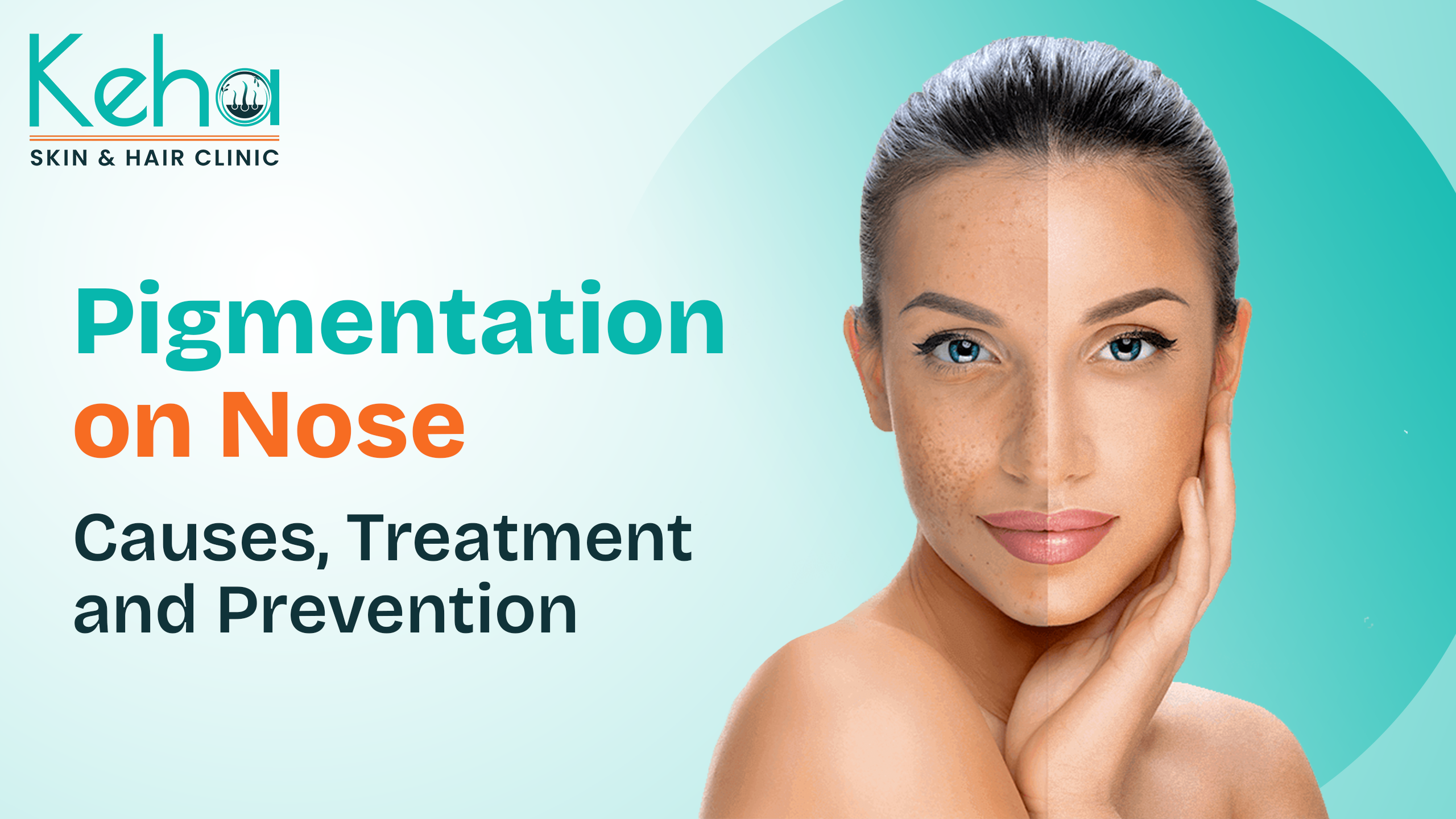 pigmentation on nose