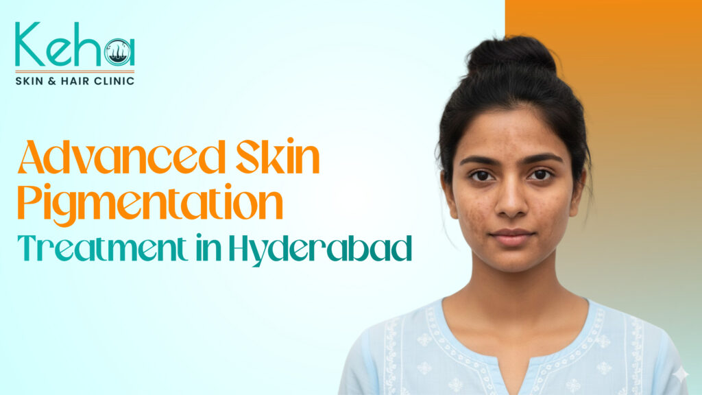 Advanced Skin Pigmentation Treatment in Hyderabad – Expert Care at Keha Skin & Hair Clinic 1 skin pigmentation treatment in hyderabad