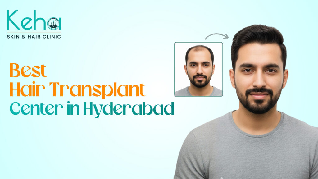 Best Hair Transplant Center in Hyderabad, Keha Skin and Hair Clinic 1 best hair transplant center in hyderabad