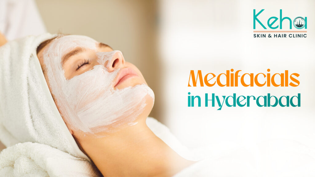 Medi Facial Treatment in Hyderabad for Healthy & Glowing Skin 1 medi facial treatment in hyderabad