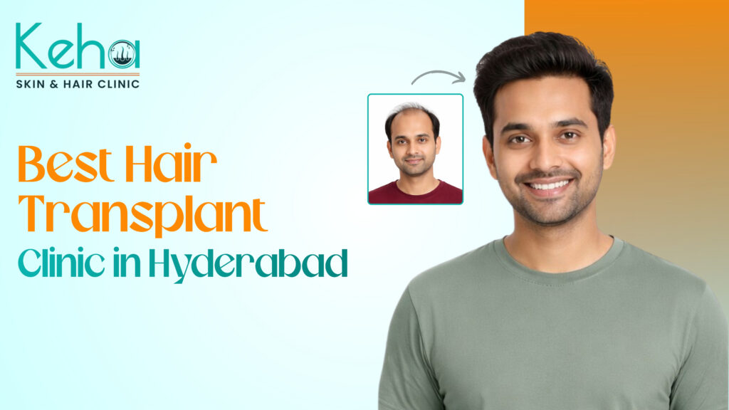 Best Hair Transplant Clinic in Hyderabad - Keha Skin & Hair 1 hair transplant clinic in hyderabad