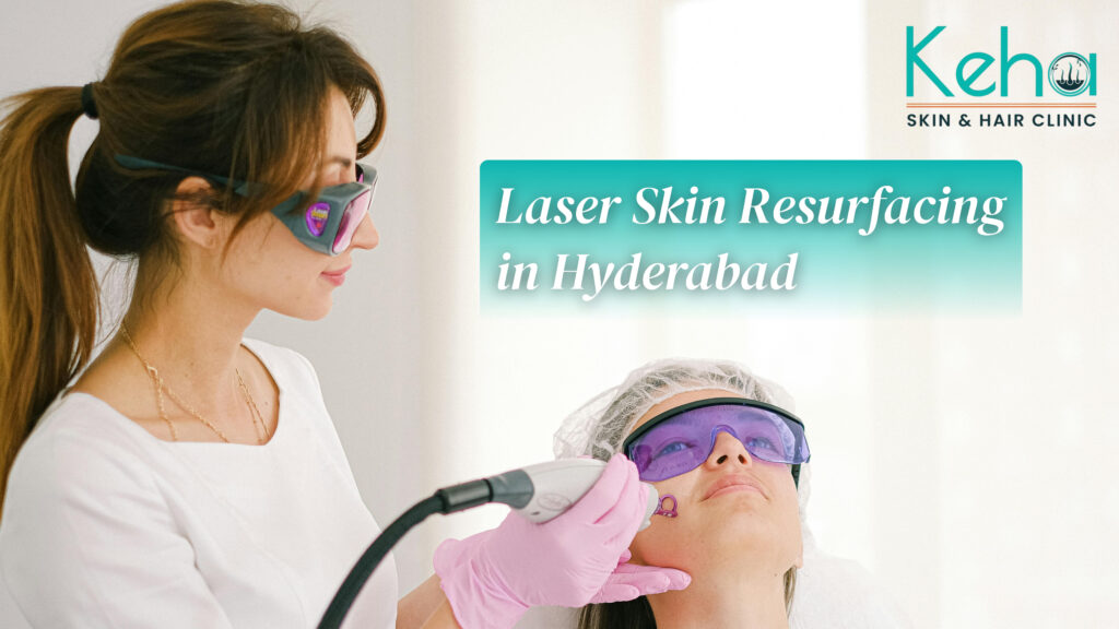Laser Skin Resurfacing in Hyderabad: Cost, Benefits, Procedure 1 laser skin resurfacing in hyderabad